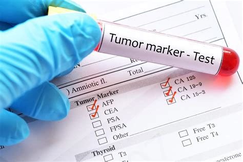marcadores tumorales